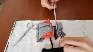 Пластика по Жирару-Спасокукоцкому со швом Кимбаровского