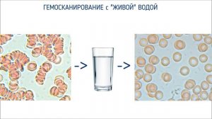ВОДА ЦЕЛИТЕЛЬ. Как вода влияет на здоровье. И как приготовить целебную воду.