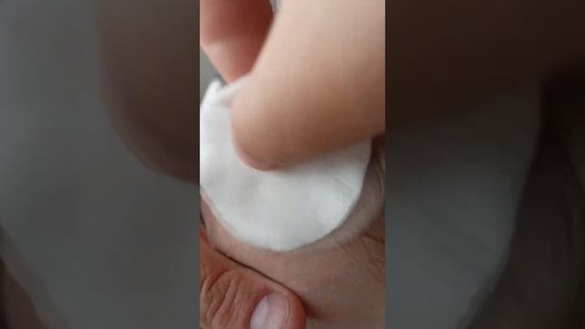 Как избавиться от прыщей на лице. Рабочий способ. смотреть онлайн