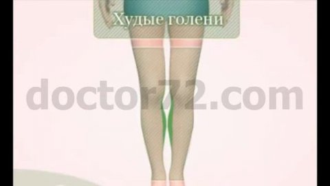 Круропластика (пластика голеней)