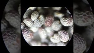 Вот Как Оказывается Выглядят Семена Мака Под Микроскопом