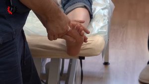 Ударно-Волновая_Терапия_при_Hallux_valgus.mp4