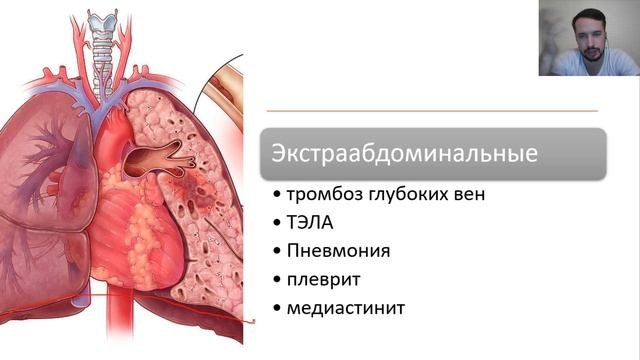 Лекция. Острый перитонит. А бывает хронический?