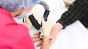 Удаление татуировки лазером До и После в Москве