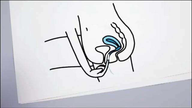 Как вводить тампон смотреть онлайн