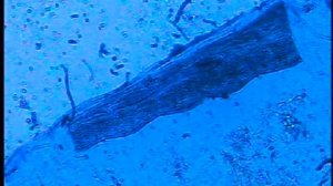 Мышечные волокна пиявки в продольном разрезе. Спектрозональная безлинзовая обзорная микроскопия