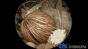 Эндоскопическая система DS.Vision FHD 3in1 - краткий обзор