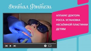 Аппарат доктора Росса. Установка несъёмной пластинки детям