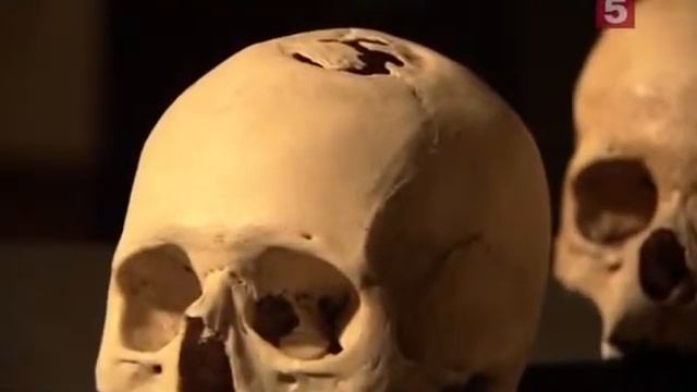 Древние открытия   Тайны древней медицины  History Channel HD