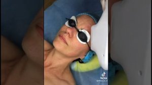 Элос омоложение лица