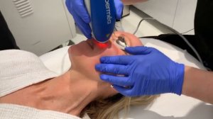 Clear + Brilliant Laser | Skin Rejuvenation | West Hollywood, CA | Dr. Jason Emer