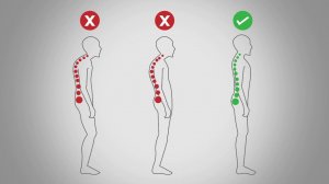 «Интенсивный комплекс для коррекции осанки (семейный)»
