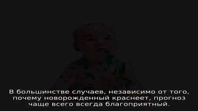 Красная кожа у новорожденного — причины, когда пройдет покраснение смотреть онлайн
