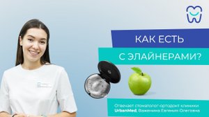 Как есть с элайнерами?