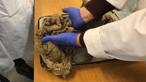 Анатомия. Топография Брюшной Полости (Ч2).