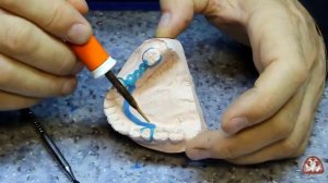 Моделировка Бюгеля