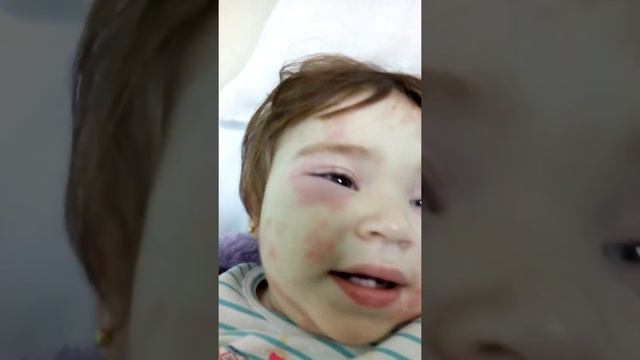 OLHA Ana Laura no hospital com alergia a remédio ?? смотреть онлайн