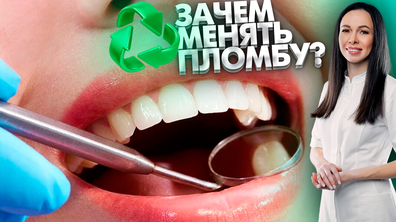 Зачем нужно менять пломбы на зубах? Стоматология. Лечение зубов. Зубы.