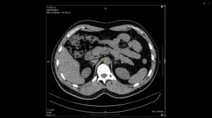 Сохранение снимков и фрагментов для экспорта в Vidar Dicom Viewer