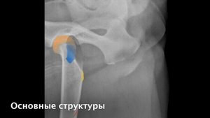 Глава 5. Нормальная рентгеноанатомия тазобедренного сустава собаки.