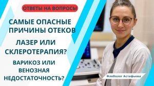 САМЫЕ ОПАСНЫЕ ПРИЧИНЫ ОТЁКОВ. ЧТО ЛУЧШЕ - ЛАЗЕР ИЛИ СКЛЕРОТЕРАПИЯ?