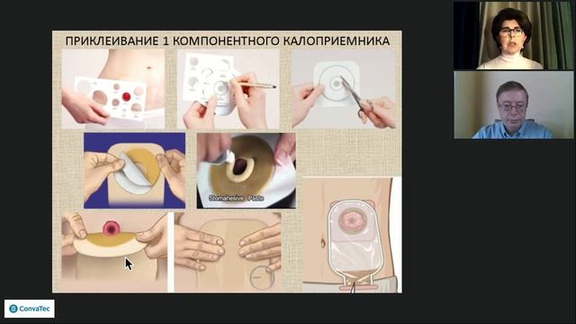 Вебинар 21.04.2020г. «Уход за стомой в условиях самоизоляции» смотреть онлайн
