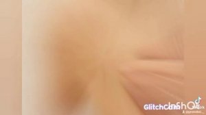 ⚡Не Рекомендуется СМОТРЕТЬ СЛАБОНЕРНЫМ. Чесотка и его клещ. Видио для школы! Коротко о чесотке!