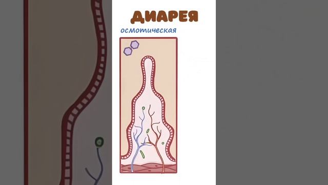 Диарея (секреторная и осмотическая) смотреть онлайн