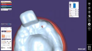 Individual Impression Tray design in Exocad / дизайн индивидуальной ложки
