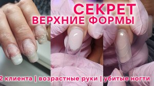 СЕКРЕТ ВЕРХНИХ ФОРМ | Постановка форм | Ремонт убитых ногтей