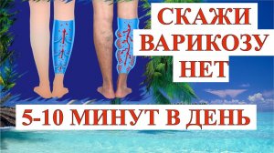 ✔5-10 МИНУТ В ДЕНЬ И ВЫ ЗАБУДЕТЕ ПРО ВАРИКОЗ