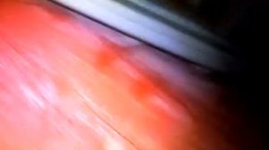 Когда шипит радио