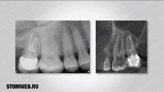 3D диагностика смотреть онлайн