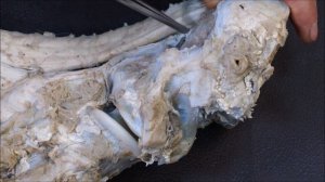 височно-челюстной, затылочно-атлантный, атланто-осевой суставы