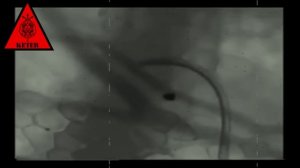 SCP-149 "Кровавые мухи"