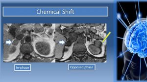 How To Recognize MRI Sequences: Part II