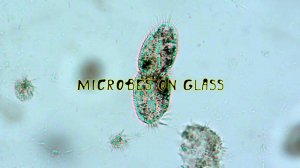 Инфузория-туфелька (лат. Paramécium caudátum), деление.