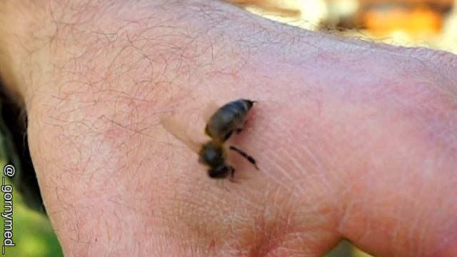 Апитерапия, укус пчелы в слоу-мо / Apitherapy, bee sting slow-mo