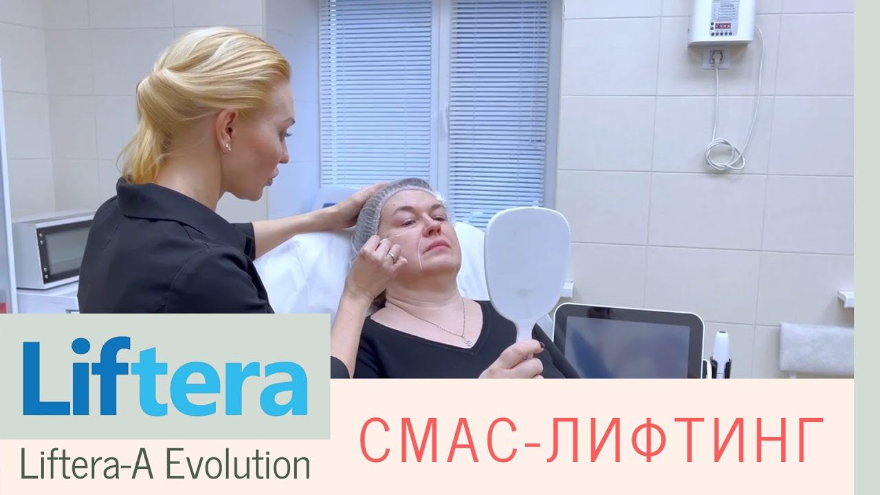 SMAS-лифтинг для лица с деформационным типом старения