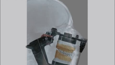 Артикулятор