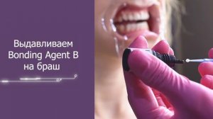 Обучение скайсы / последовательность процедуры украшения зубов скайсами из набора Mini Gems / скайс