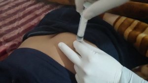 как делать укол в ягодицу взрослым
