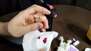 Что делать если вы придавили палец, и ноготь почернел