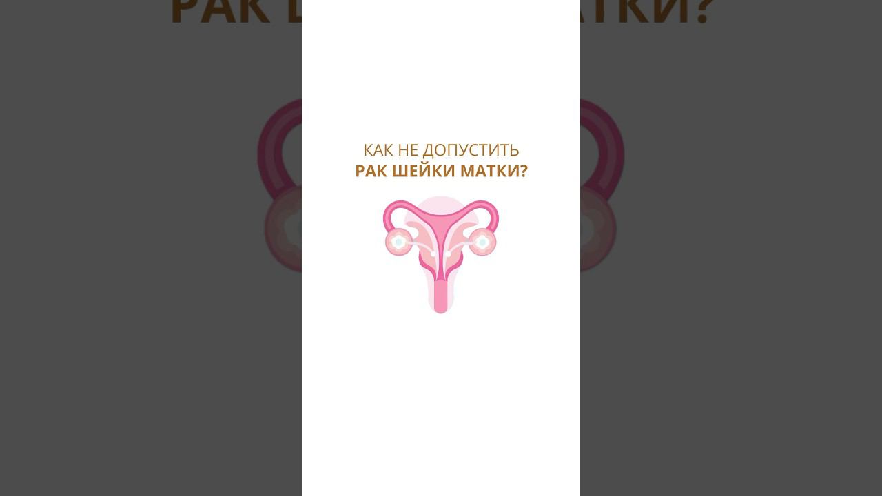 Как не допустить рак шейки матки? #ракшейкиматки #онколог #гинеколог #женскоездоровье
