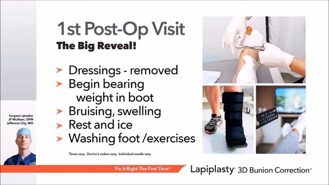 Lapiplasty Educational Webinar смотреть онлайн