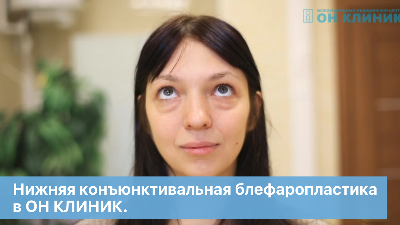 Нижняя конъюнктивальная блефаропластика в ОН КЛИНИК.