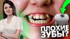 Такое понятие, как «плохие зубы», имеет право на существование? Консультация стоматолога.