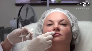 Линейно ретроградно и инфильтрационно капельно корректируем носогубку