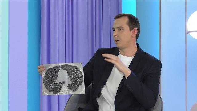 Вся правда о курении от пульмонолога. смотреть онлайн