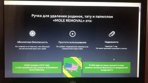 УДАЛЕНИЕ ПАПИЛЛОМ, РОДИНОК - Mole Removal